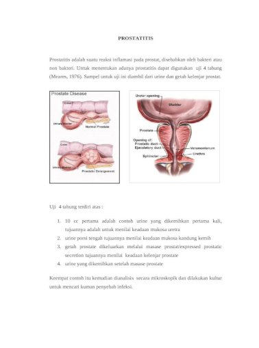 prostatitis klebsiella